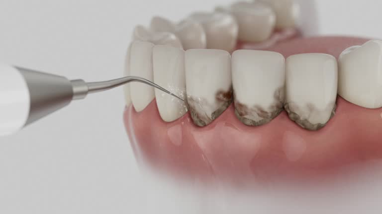 Trusted Teeth Cleaning And Checkup service in Hillsboro, WI - Dentist Open Now